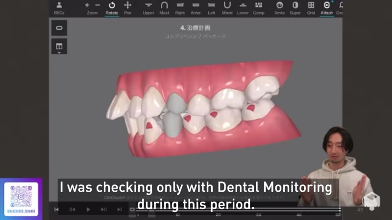 Treatment planning with ClinCheck