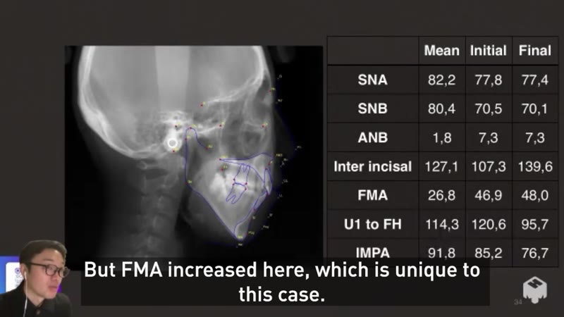 Cephalometric analysis